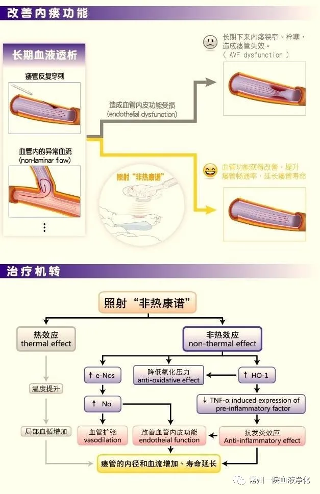 血液透析好幫手-非熱康譜血透內(nèi)瘺治療儀